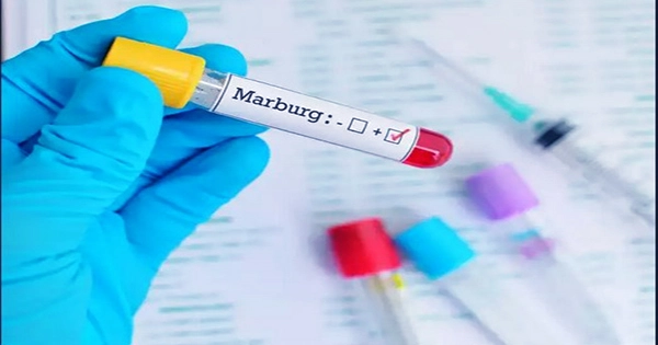 Equatorial Guinea Reports the First-ever Epidemic of the Marburg Virus Sickness