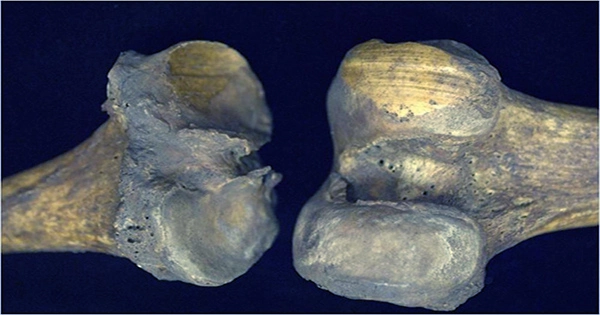 A Researcher Finds Fossae on a Bone Sample. What is The Scientist’s Conclusion?